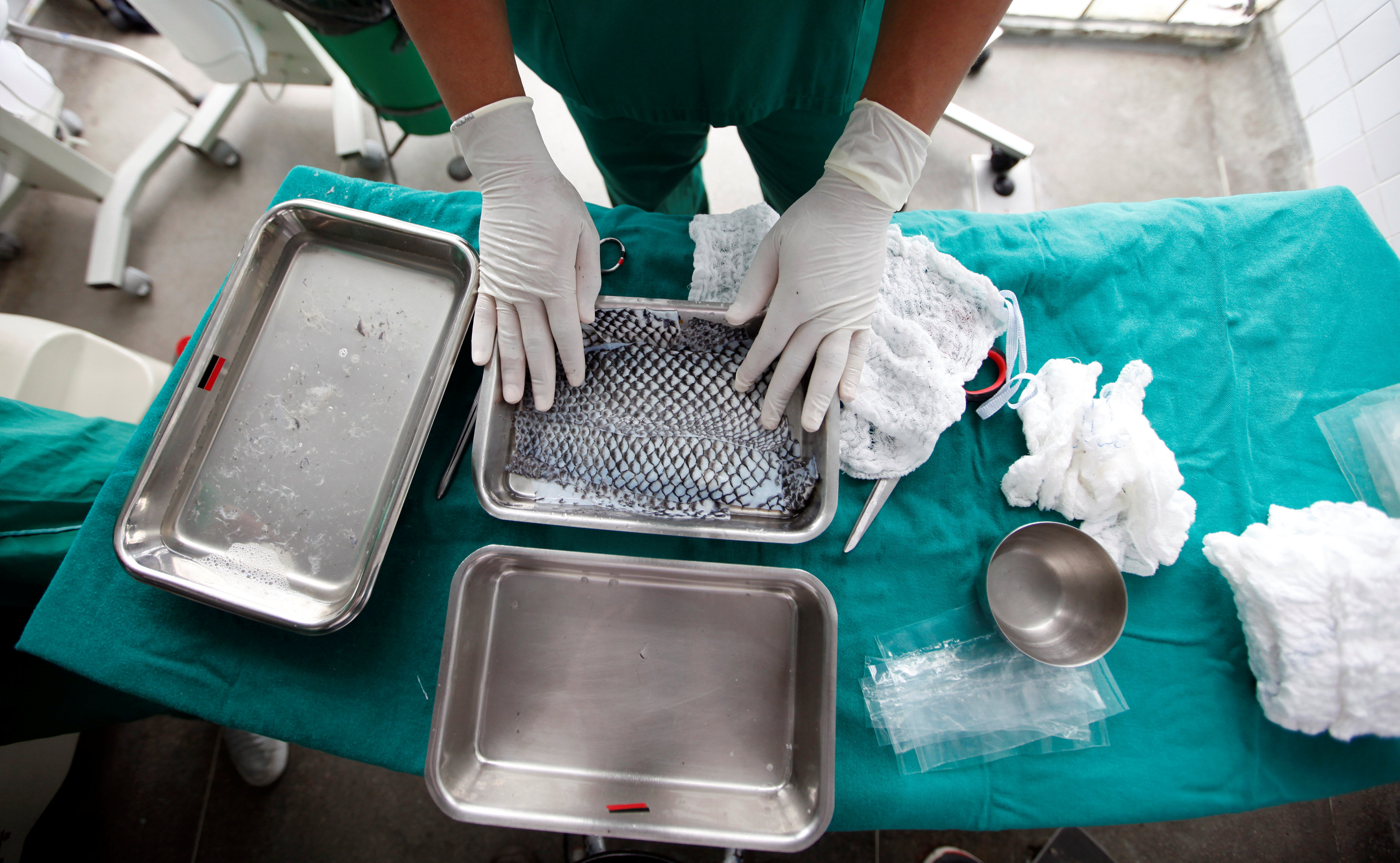 A medical volunteer prepares sterilised tilapia fish skin to be applied to patients with burnt skin at Dr. Jose Frota Institute in the northeastern costal city of Fortaleza, Brazil, April 18, 2017. REUTERS/Paulo Whitaker SEARCH "FISH BURN" FOR THIS STORY. SEARCH "WIDER IMAGE" FOR ALL STORIES.